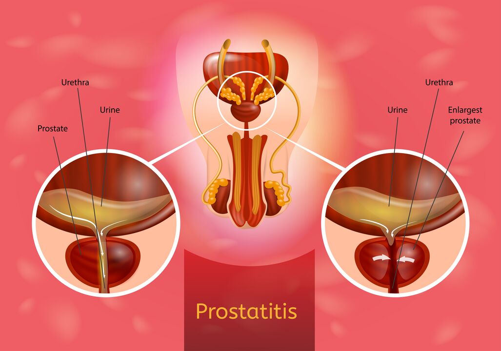Próstata